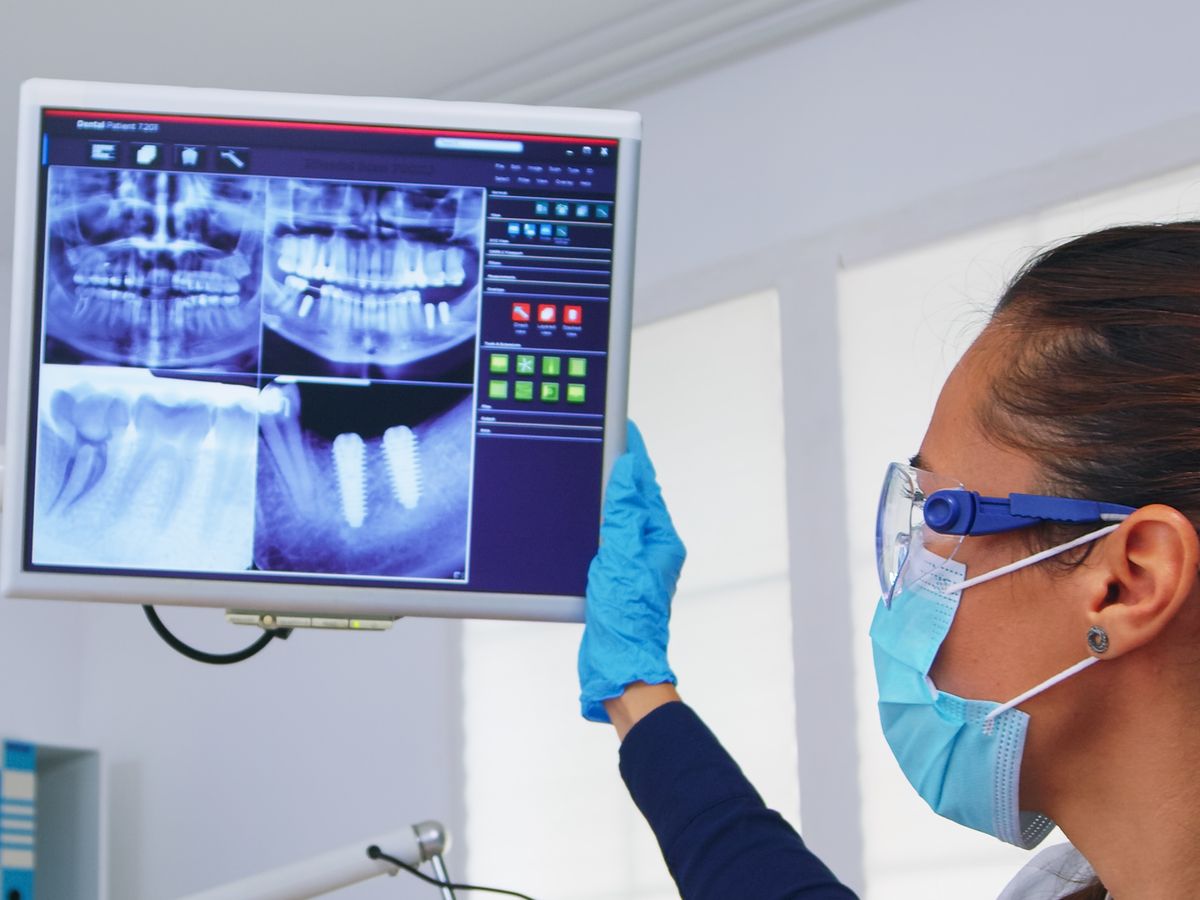 Dental X-rays displayed on an operatory monitor